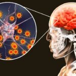 brain-infection_-encephalitis-vs.-meningitis-checkout-complete-details-here